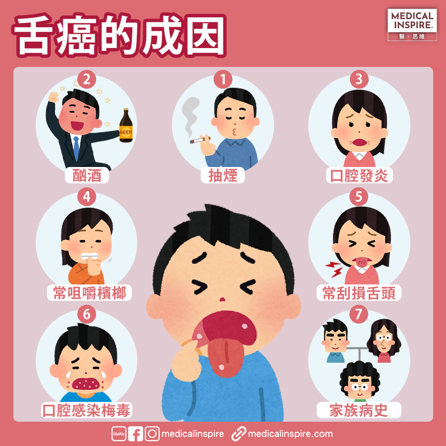 口腔出現瘡點是生痱滋還是患舌癌?|邱騏驄醫生 – 優尚醫療